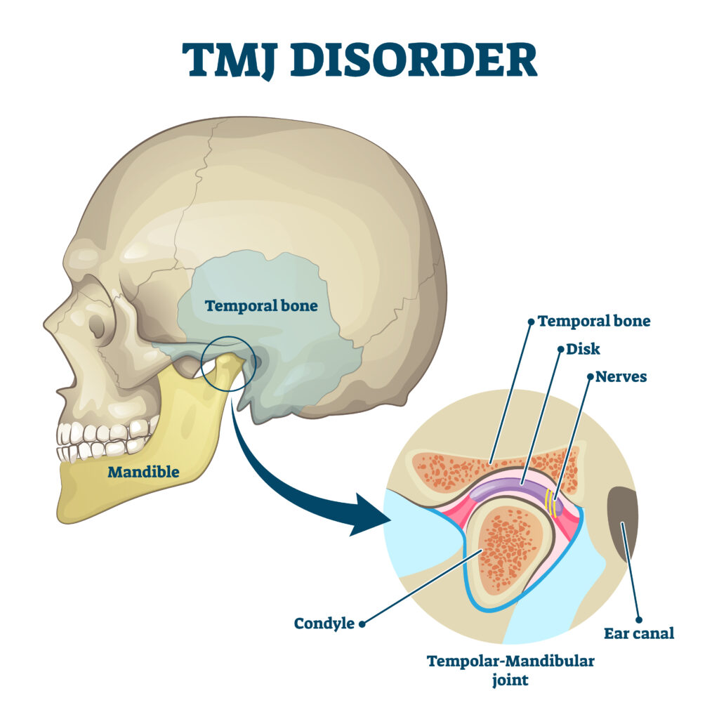 TMJ physiotherapy